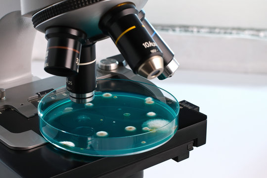 petri dish in the laboratory microscope / petri plate in micro on workbench of lab
