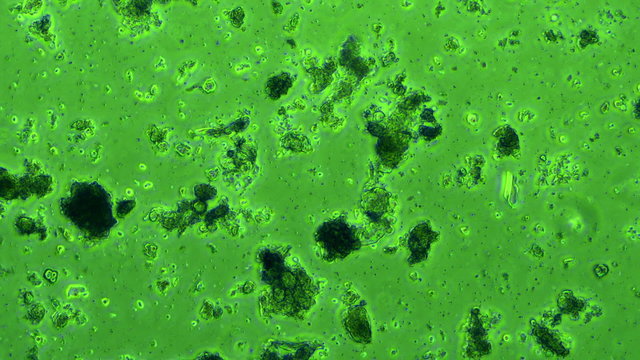 Plaque Bacteria from mouth seen in phase microscope 600x with Green Filter
