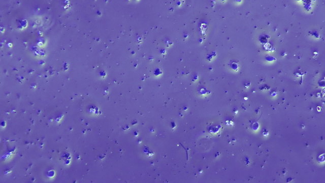 Bacteria Flagellum Swimming In Phase Contrast Microscope at 800x magnification.