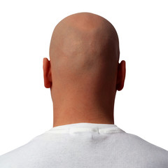 Bald man