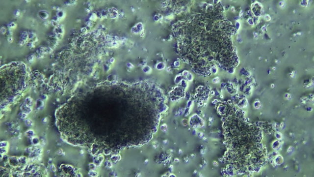 Decomposing Organic Flesh With Bacteria Microscope view 800x