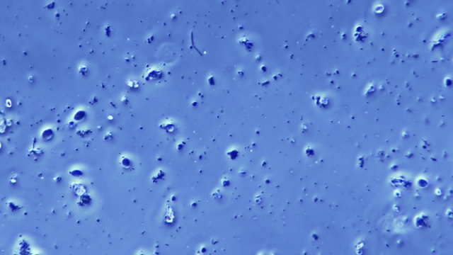 Bacteria Flagellum Sample In Phase Contrast Microscope at 800x magnification.