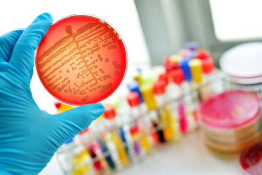 Colonies of bacteria in culture medium plate
