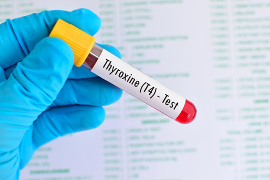 Blood sample for thyroxine (T4) hormone test

