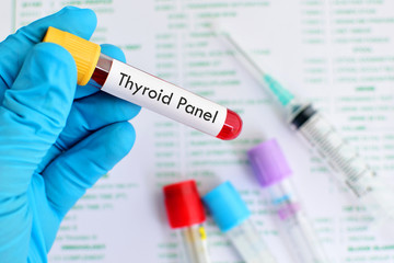 Blood sample for thyroid panel test
