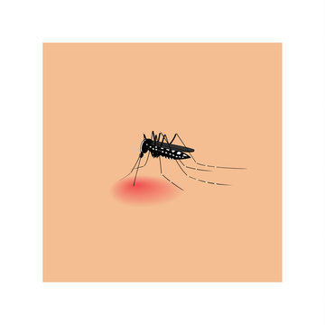 Vector image of a mosquito biting skin