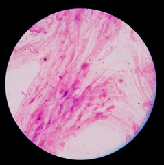 bacteria