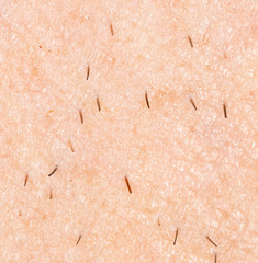 the bristles on the skin. macro