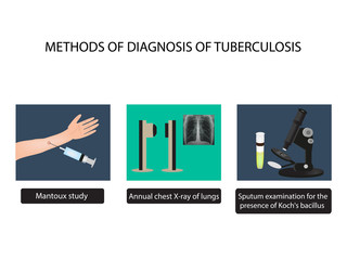 TB diagnostic methods. X-rays of light. Mantoux test. Examination of sputum. World Tuberculosis Day. Infographics. 