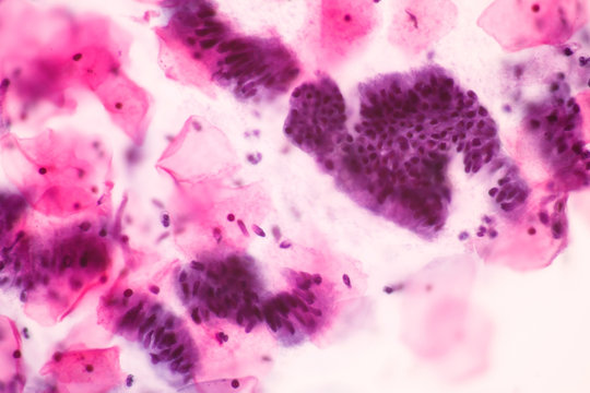 Normal endocervical cells and squamous epithelial cells of cervical human view in microscopy.Cytology criteria from pap smear.Columnar and cilia cells.Medical background concept