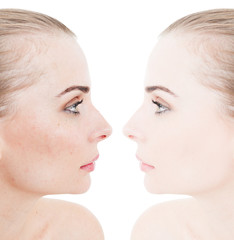 Closeup face of beautiful young woman before and after retouch