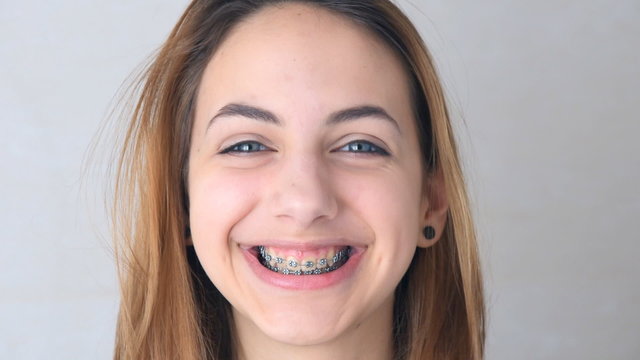 Beautiful smiling girl with retainer for teeth .