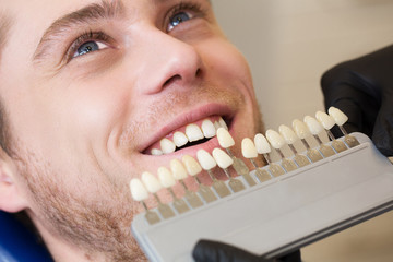 Close up portrait of Young man in dentist chair, Check and select the color of the teeth. Dentist...