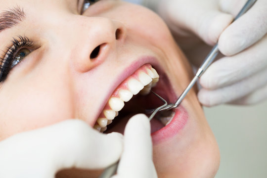 Close-up Of Female With Open Mouth During Oral Checkup At The Dentist