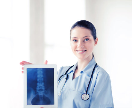female doctor with x-ray on tablet pc
