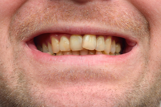 Detailed image of man showing his teeth. Dental health care. Hyg