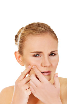 Unhappy young woman squeezing pimple on face