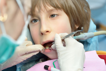 Stomatologist. Dental health. Female dentist curing a child pati