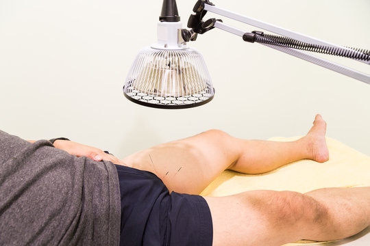 Acupuncture patient being treated with needles and infrared heat lamp