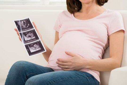Close-up Of Pregnant Woman Holding Ultrasound Image Of Baby