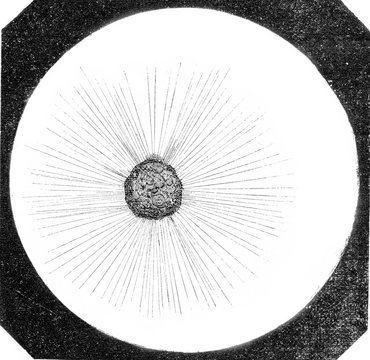Actinophrys sun, Actinophrys ground, magnified 250 times, vintag