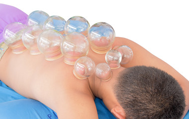 Fire  Cupping  Removal, select focus front Fire Cupping  Removal  therapy of Glass Globe  on White background
