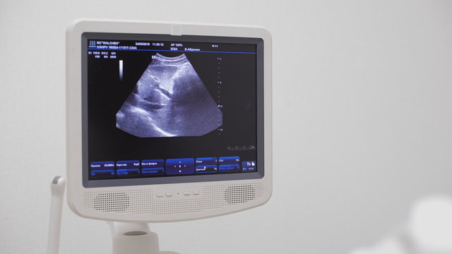 Doctor using the ECHO