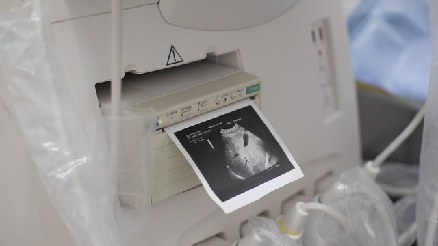 Dr. prints picture. Ultrasonic and work with it
