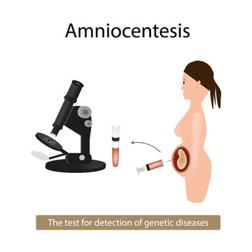 Amniocentesis. Analysis of amniotic fluid. Pregnant woman. Genetic diseases. Vector illustration on isolated background