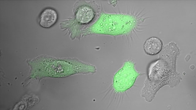 PC-3 human prostate cancer cell lines are one of the cell lines used in prostate cancer research.
