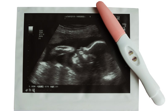 Ultrasound picture of baby with pregnancy test