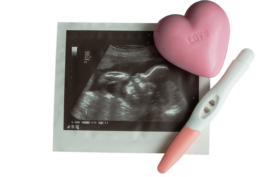 Pregnancy concept with ultrasound picture of baby
