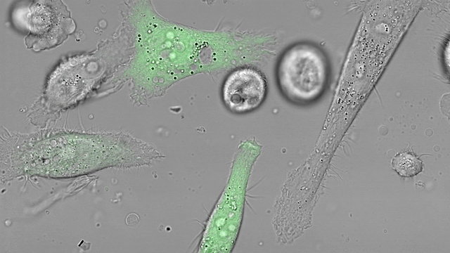 PC-3 Human Prostate Cancer Cell Lines Are One Of The Cell Lines Used In Prostate Cancer Research.
