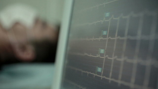 ECG monitor screen in hospital 