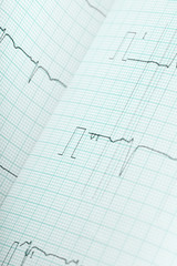 ECG medical background