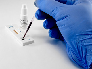 Test, troponin, on myocardial infarction