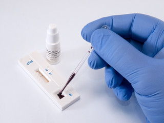 Test, troponin, on myocardial infarction
