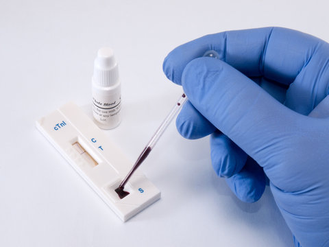 Test, troponin, on myocardial infarction