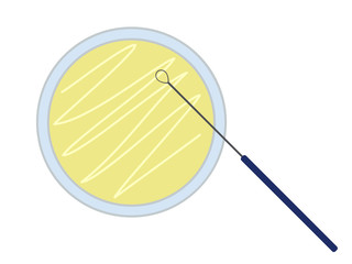 Petri dish with nutrient medium and inoculation loop
