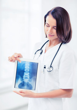female doctor with x-ray on tablet pc
