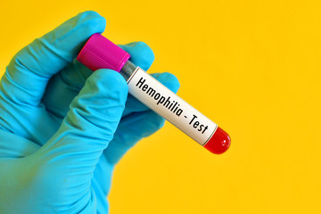 Hemophilia test
