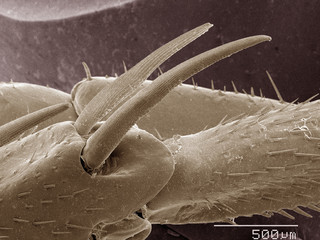 Coloured SEM of American cockroach leg