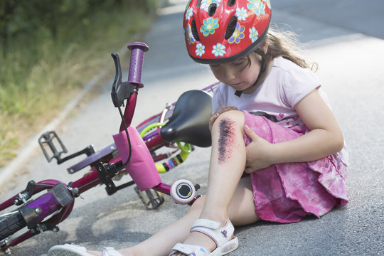 Young girl with injured leg sitting on road with bicycle