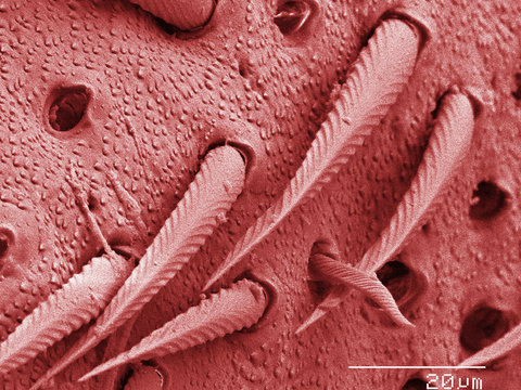 Coloured SEM of house cricket (Acheta domesticus) leg spurs