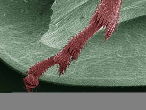Coloured SEM of spittlebug (Cercopidae) leg