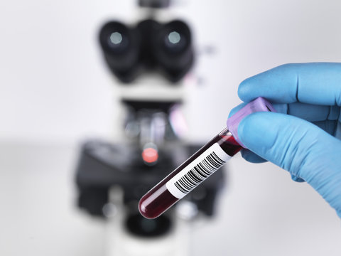 Laboratory scientist holding a blood sample with a upright compound microscope in the background