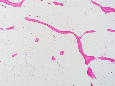 H&E stain, light microscopy, osteoporosis, bone