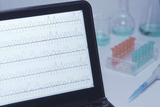 A laptop computer displays results of automated DNA sequencing on its screen