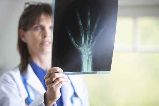 Doctor looking at xray image of hand