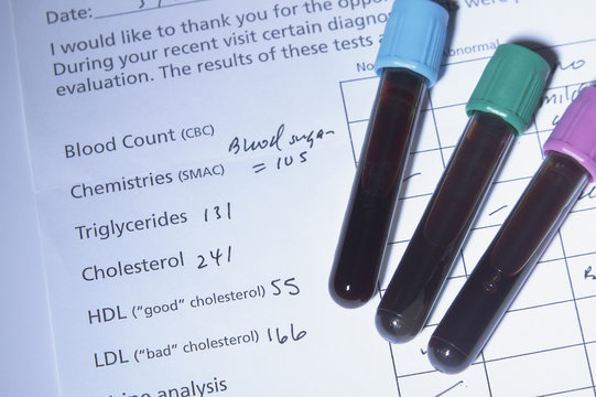 Blood tubes on the results of blood testing, including testing for cholesterol. Such testing is done commonly as part of a yearly health checkup. Synthetic blood is used in this studio shot